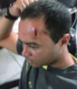 Agente Funase ferido