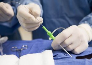 cateterismo-cardiaco